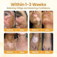 🐝 Bee Venom Vitiligo Cream